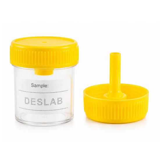 Colector Parasitológico Flubiol 30ml