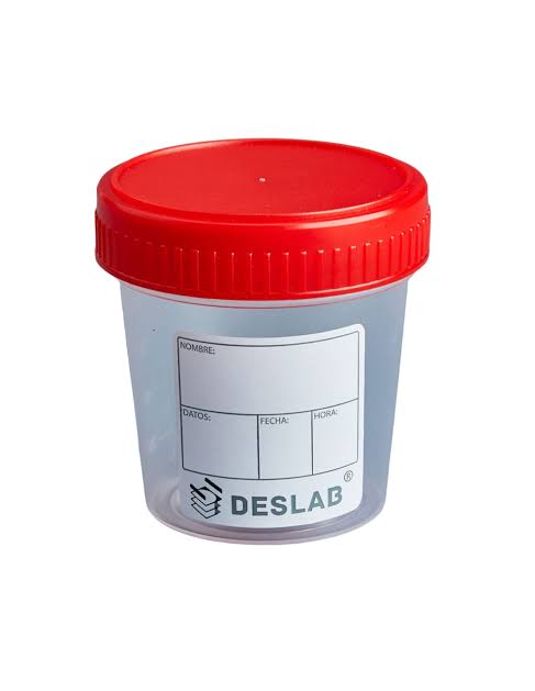Colector No Estéril de Orina 120ml (graduado 100ml)